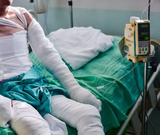 Everything You Need to Know About Burn Injuries